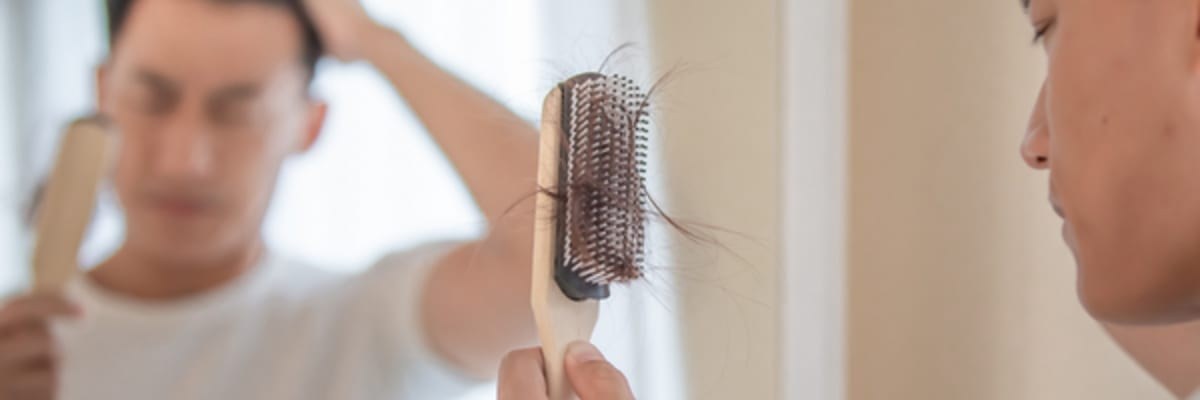 10 Evidence-Based Facts About Male and Female Hair Loss