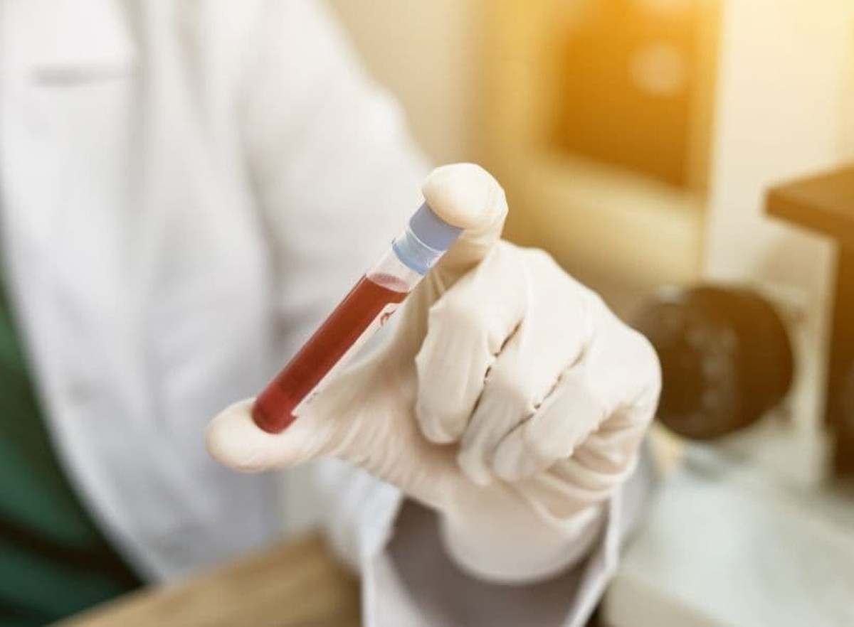 Do You Have High Cholesterol? Silent Risks, Lipid Panel Testing & Home Fingerstick Checks
