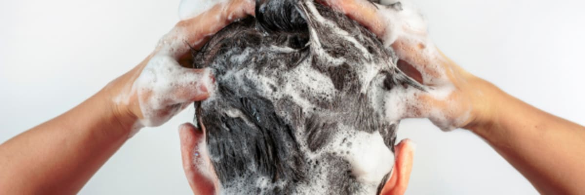 Do You Need to Wash Your Hair Every Day When Using Topical Minoxidil?