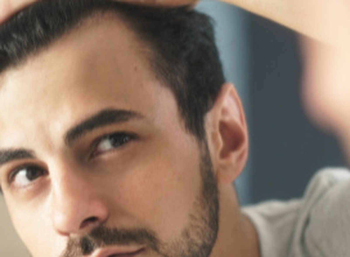 Male Pattern Hair Loss: Understanding DHT Miniaturization & Comparing Proven Treatments