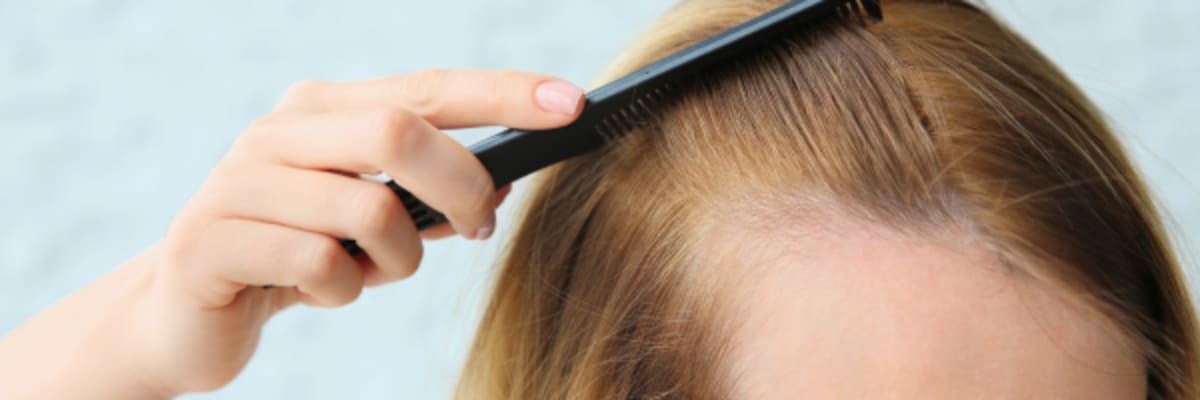 Post-Hair Transplant Care for Women: Recovery, Minoxidil & Hormone Safety