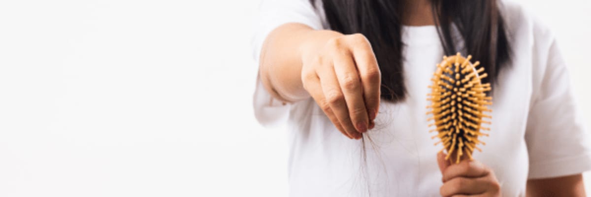 Topical vs. Oral Hair Loss Treatments: Which Fits Your Lifestyle Best?