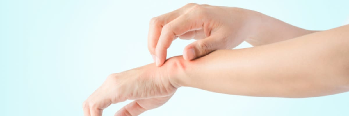 Understanding Eczema: The 7 Types, Household Triggers, Ointments vs. Creams & Treatments