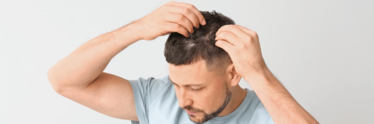 What Happens When You Stop Taking Finasteride? Clearance & Hair Timeline