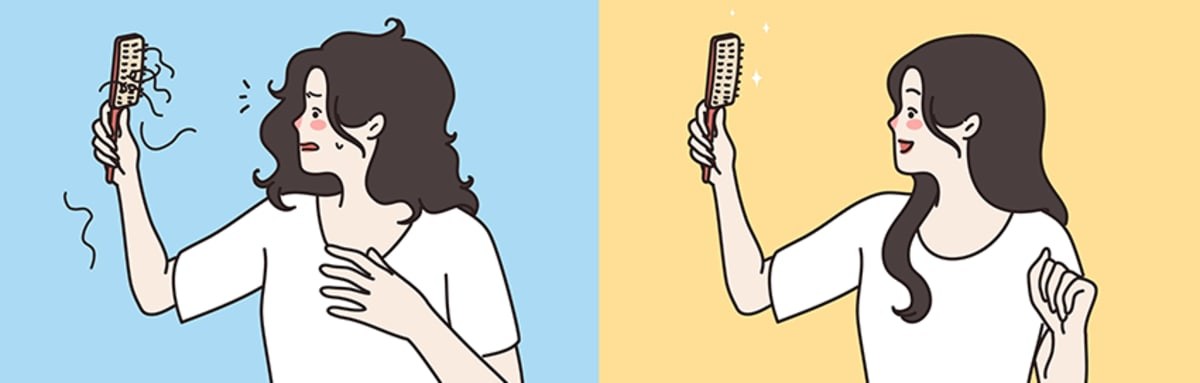Hair Loss in Women: Causes, Ferritin & Vitamin Checks, and Proven Treatments